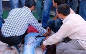 Nusaybin'de Bıçaklı Kavga: 3 Yaralı 