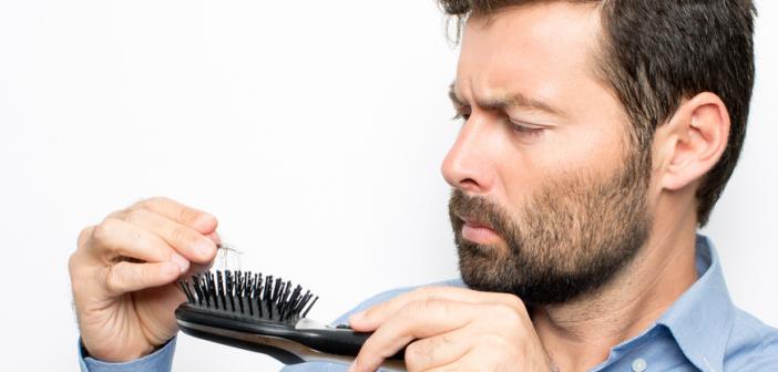 Saç dökülmesi neden olur ve nasıl önlenir? Saç dökülmesinin sebepleri ve tedavisi