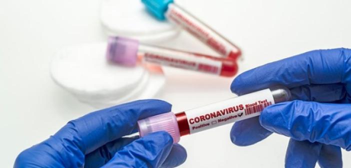 9 Mayıs koronavirüs tablosu açıklandı! İşte bugünkü vaka sayısı ve kritik gelişmeler