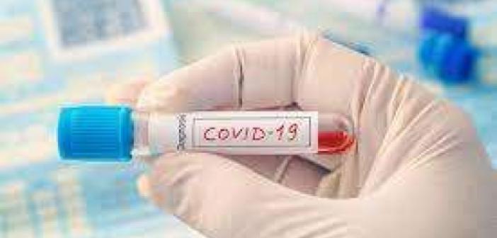 Türkiye'de Covid-19 nedeni ile 62 kişi vefat etti, 5 bin 904 yeni vaka tespit edildi