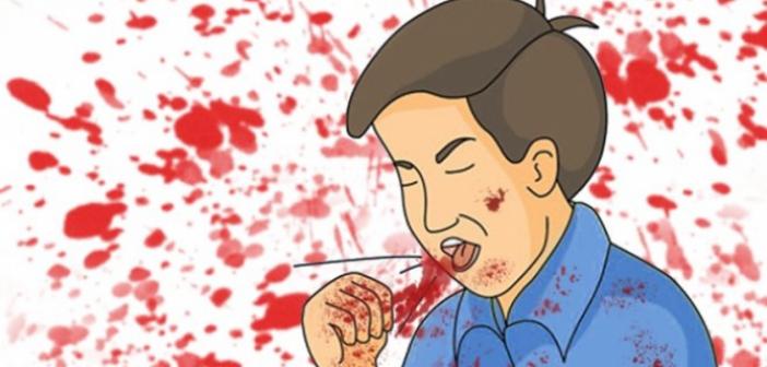 Rüyada Ağızdan Kan Gelmesi ne anlama gelir? Rüyada Ağızdan Kan Gelmesi ne demek?