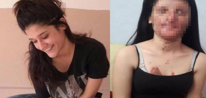 Berfin Özek kimdir, nereli, kaç yaşında? Berfin Özek olayı nedir? Berfin Özek eski ve son hali