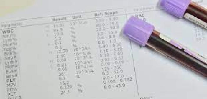 Mono nedir? Monosit (MO, MON, MONO) yüksekliği veya düşüklüğünü ne anlama gelir?