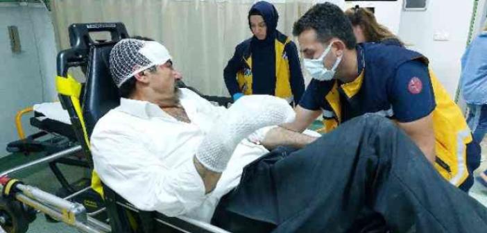 Samsun’da tüpün parlamasıyla alevler içinde kalan şahıs yaralandı