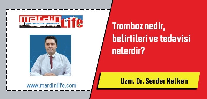 Tromboz nedir, belirtileri ve tedavisi nelerdir?