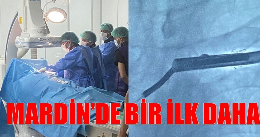 Kırık kalp pili kablosu ameliyatla çıkarıldı