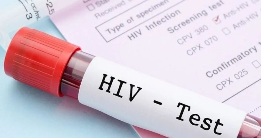 Dünya AIDS Günü nedir? Böyle bir gün neden ilan edildi? Kimler tarafından ilan edildi? Ne zaman ilan edildi? Bugüne  hangi özel etkinlikler yapılmaktadır?