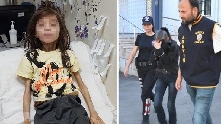 Çöp evde bulunan çocuğa teyzesi böyle işkence uyguladı