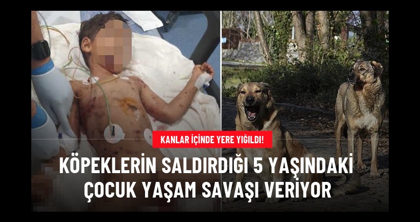 Sokak köpekleri bir kez daha saldırdı! Ağır yaralanan çocuk yaşam savaşı veriyor
