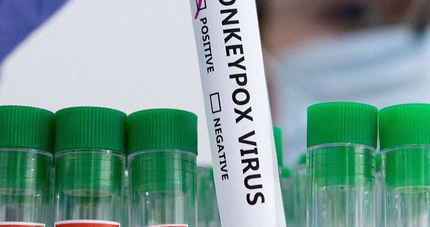 Maymun Çiçeği Virüsü: Riskler ve korunma yöntemleri