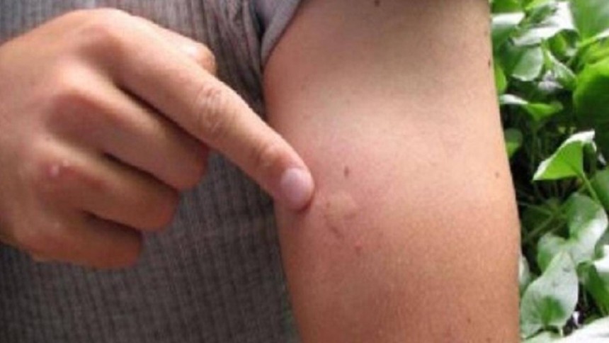 Batı Nil Virüsü nedir? Nasıl bulaşır? Belirtirleri nedir?