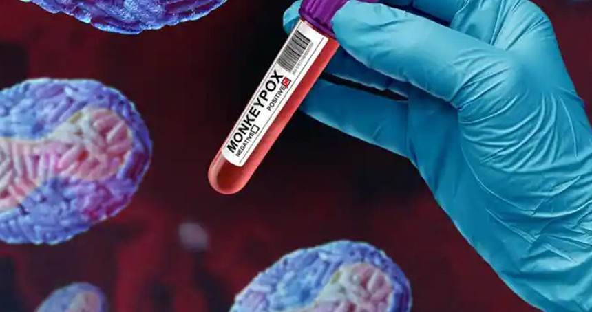 Avrupa'da M çiçeği virüsü alarmı