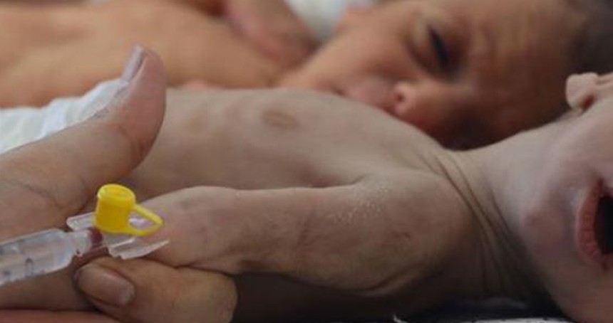 BM: Gazze'de bebeklerin yüzde 92'si açlık tehlikesi altında