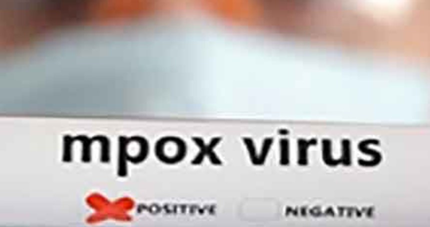 Pakistan'da maymun çiçeği vakalarında artış