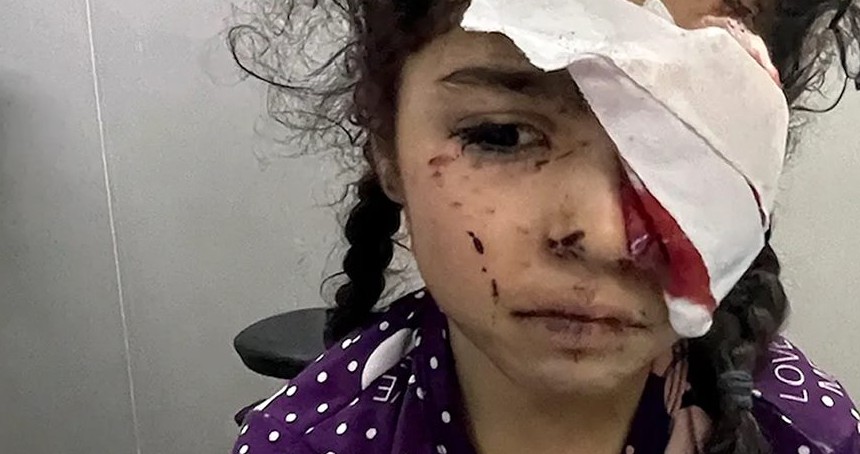 Gazze’de işgal saldırılarında 1.500 kişi görme yetisini kaybetti