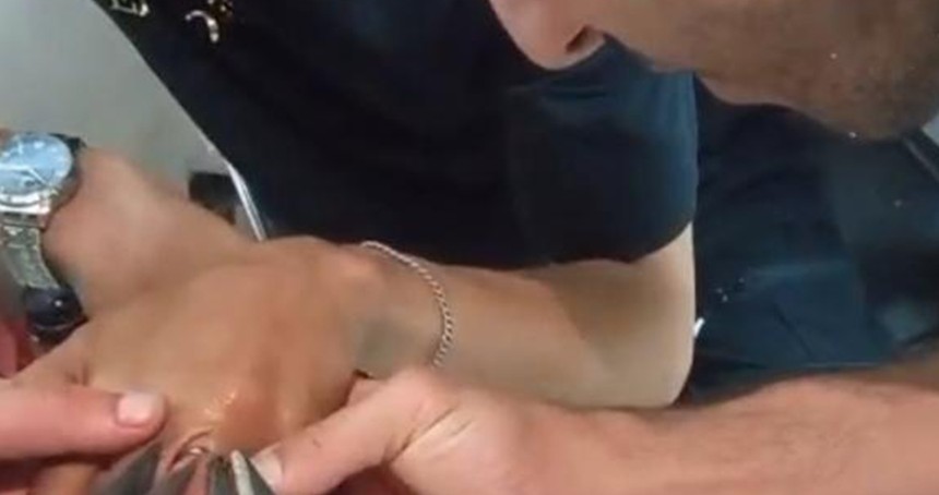 Parmağına sıkışan yüzük itfaiye ekiplerince çıkarıldı