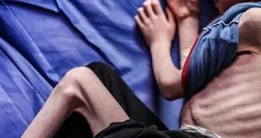 Gazze'de açlık ve ilaçsızlıktan can kayıpları artıyor