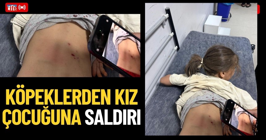 Köpeklerden kız çocuğuna saldırı