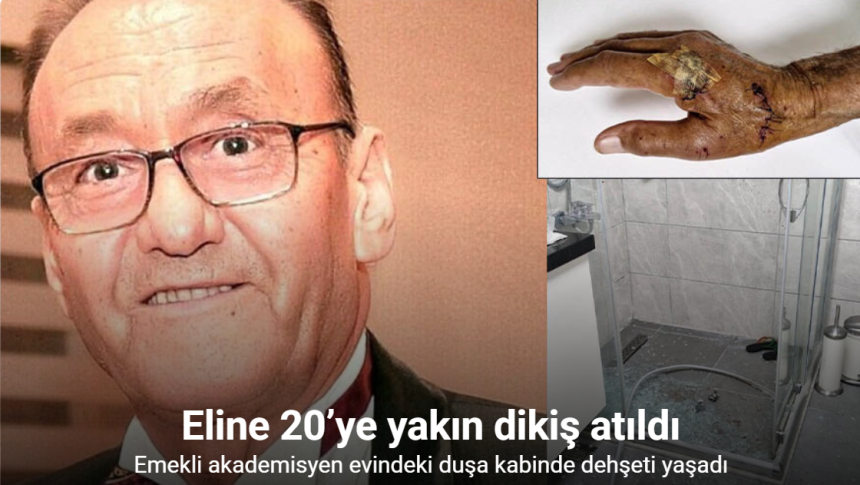 Duşa kabin patladı, eline 20’ye yakın dikiş atıldı