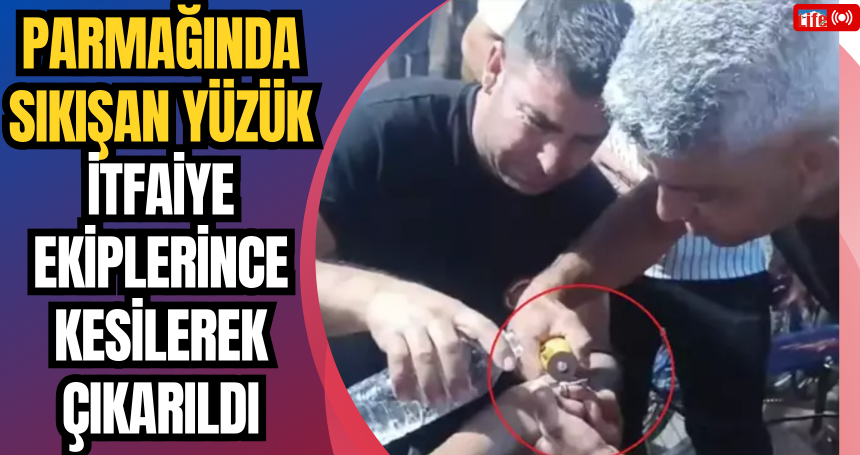 Parmağında Sıkışan Yüzük İtfaiye Ekiplerince Kesilerek Çıkarıldı