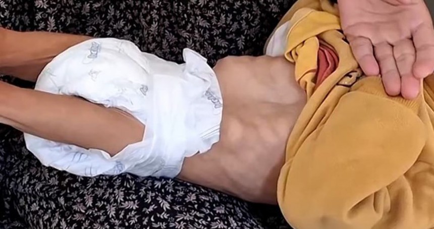 Gazze'de açlıktan ölen çocukların sayısı 66'ya yükseldi
