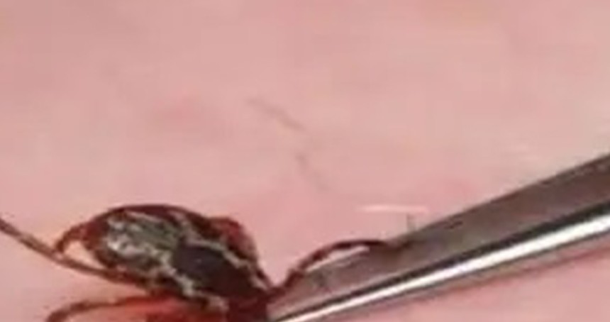 Sivas’ta vücuduna kene yapışan bir kişi hayatını kaybetti