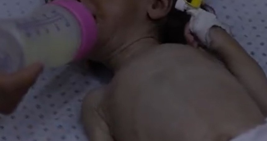 UNICEF: Haziranda Gazze'de 5 bin 800’den fazla çocuk yetersiz beslenme yaşadı