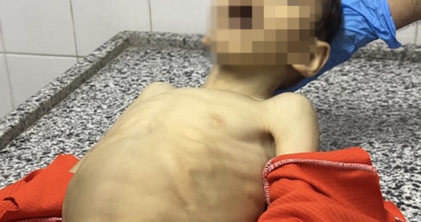 Açlık Gazze'de çocukları vurmaya devam ediyor: 3 günde 21 çocuk şehit oldu