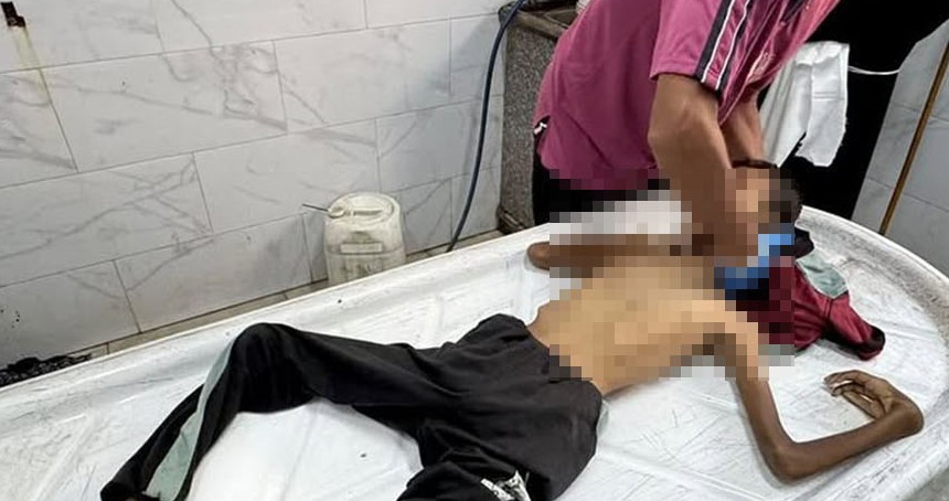 Gazze'de açlıktan yeni şehitler: Toplu ölüm uyarısı
