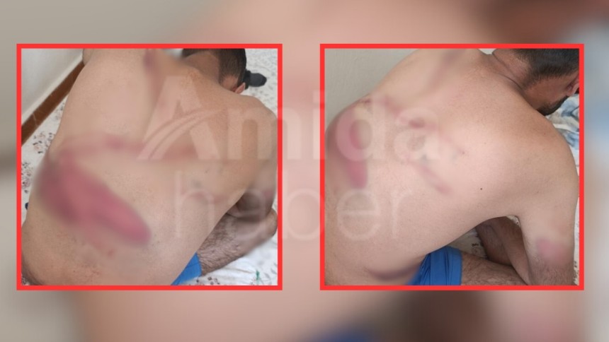 ‘tefeci’ kabusu: Saatlerce işkence yaptılar