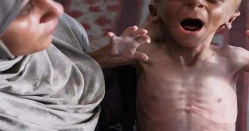 Yerel ve uluslararası kuruluşlar uyardı: Gazze’de açlık toplu kıyım aşamasında