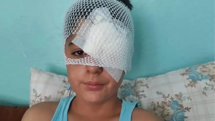 Köpek saldırısından kaçarken otomobil çarptı