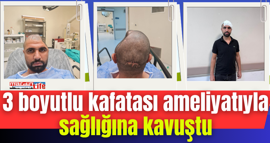 3 boyutlu kafatası ameliyatıyla sağlığına kavuştu