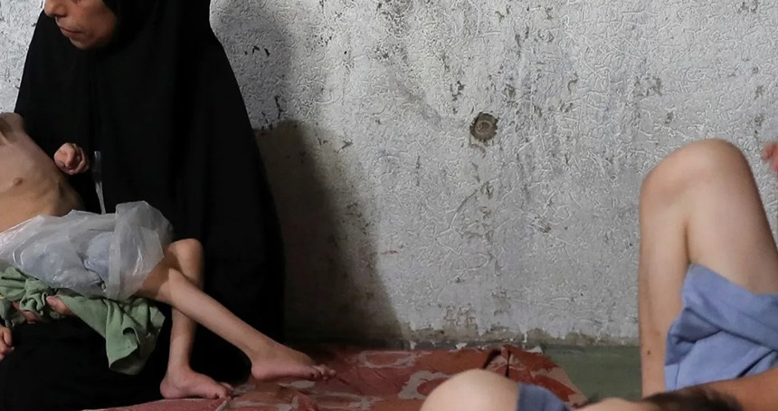 Gazze'de açlıktan ölenlerin sayısı 93'ü çocuk 180'e yükseldi