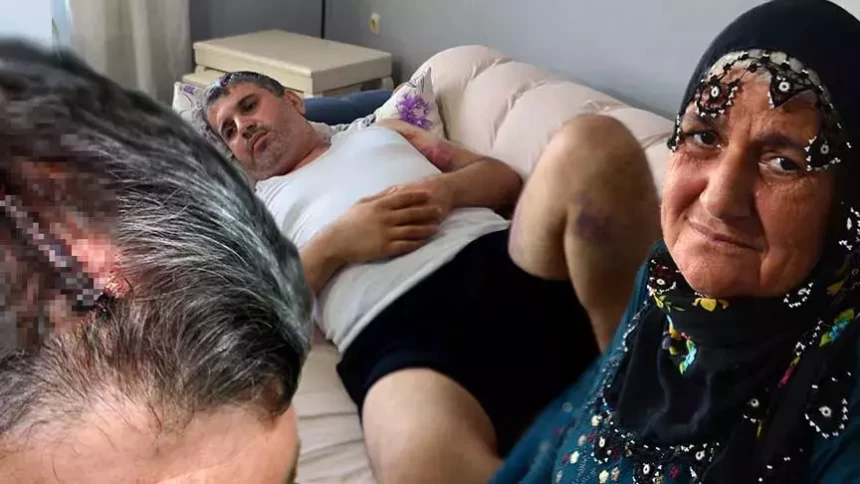 "Kadınların mirasta hakları yok" dediler, karşı çıkınca dövüldü