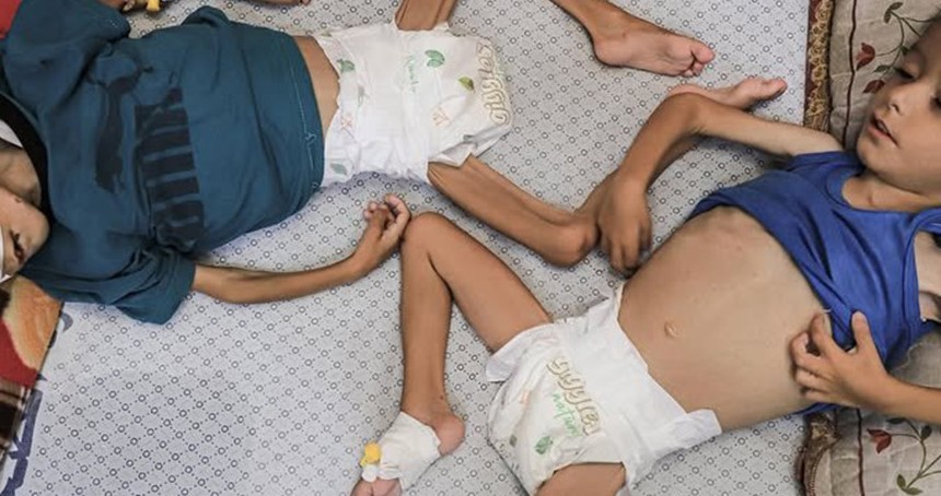 Gazze'de 18 binden fazla çocuk açlıkla boğuşuyor