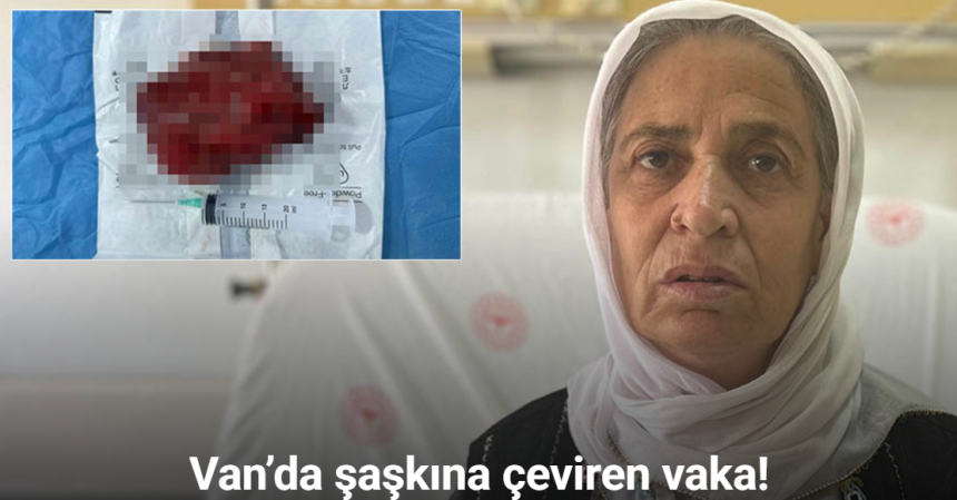 Kalbinin üzerinden 2 kiloluk kitle çıkarıldı