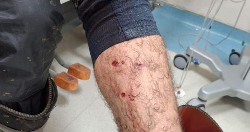 Veteriner hekim aşılama sırasında köpek saldırısına uğradı
