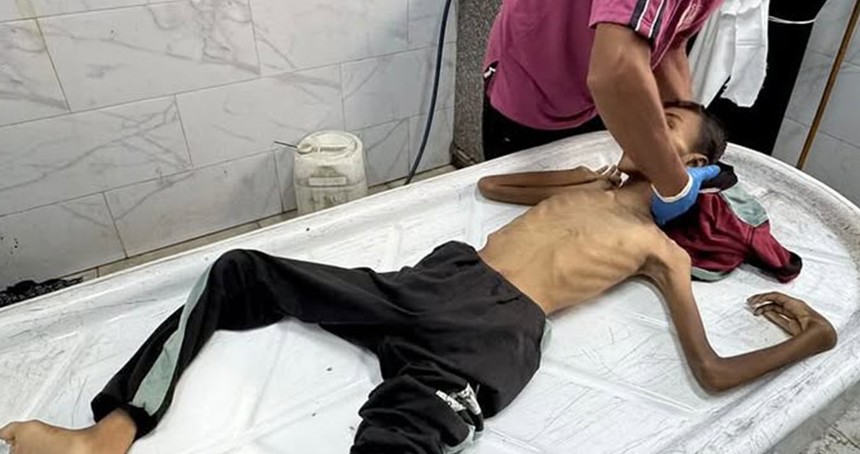 Gazze'de açlık felaketi: 10 kişi daha hayatını kaybetti