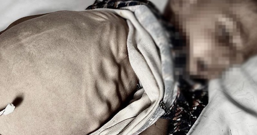 Gazze'de açlıktan ölümler artıyor: 2'si çocuk 4 kişi daha hayatını kaybetti