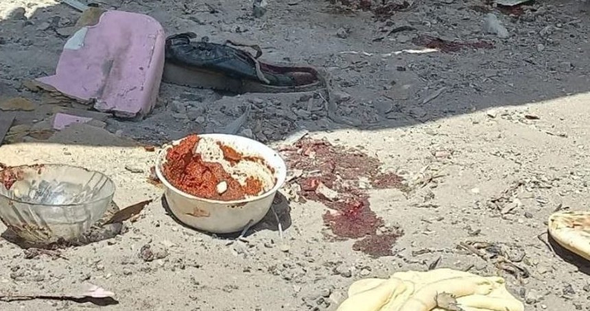 Siyonistin açlık silahı, Gazze'de bir çocuğu daha hayattan koparttı!