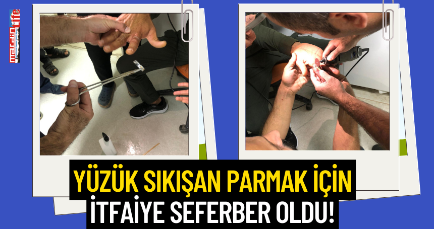 Yüzük sıkışan parmak için itfaiye seferber oldu!