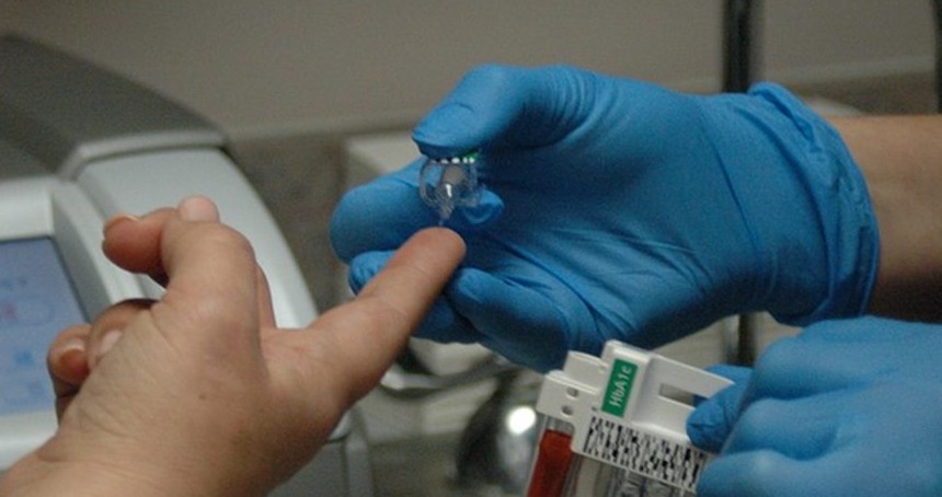 Uzmanı uyardı: Kadınlarda akciğer kanseri görülme oranı artıyor