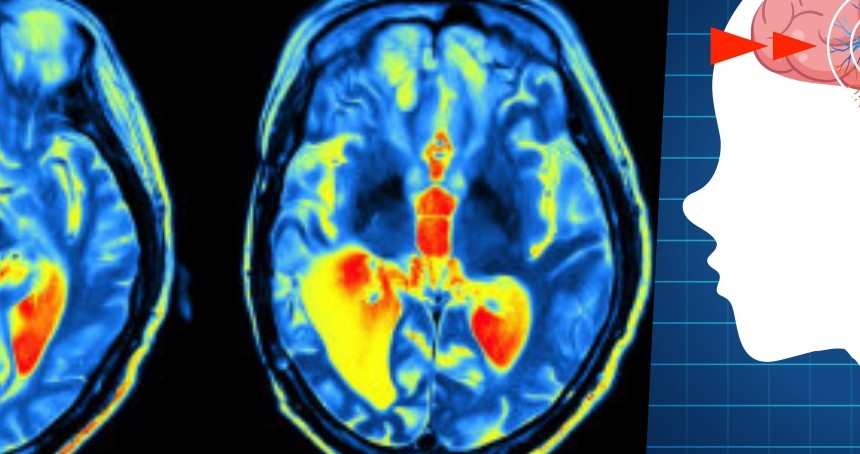 Bilim insanları beynin beş yaşam evresini belirledi: Kritik dönüm noktaları 9, 32, 66 ve 83 yaşında