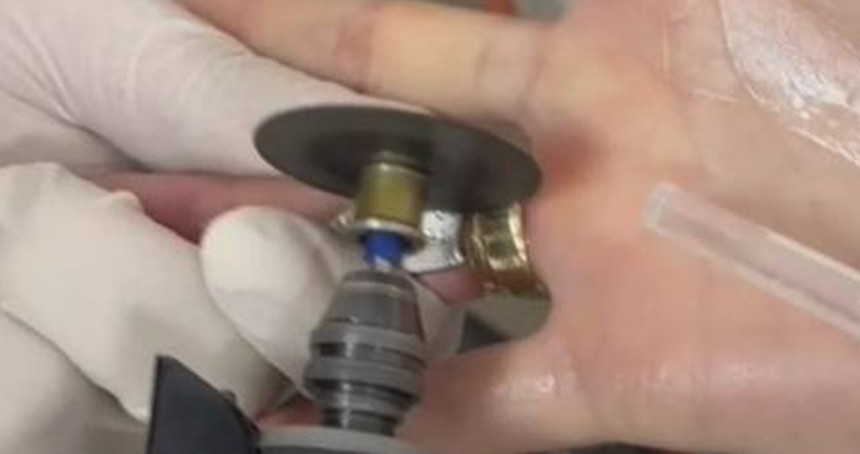 Parmağına sıkışan yüzük itfaiye ekiplerince çıkarıldı